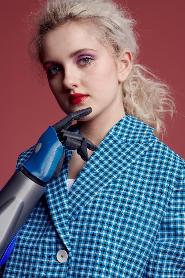 Tilly Lockey holding her right robotic hand to her chin