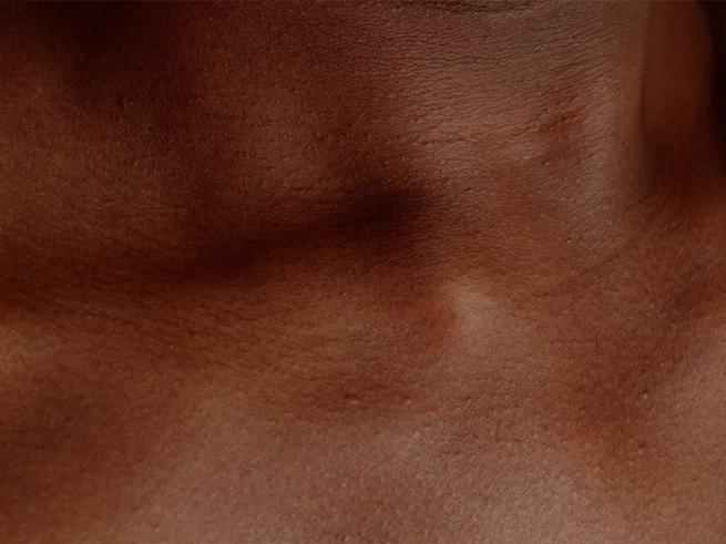 Close up photo of dark skin