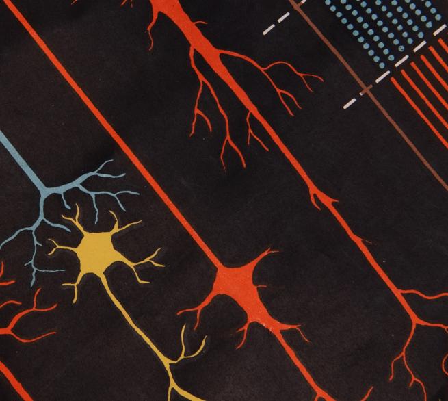 A close-up image of a brain scan